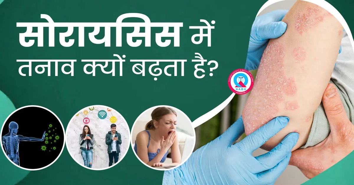 सोरायसिस-में-तनाव-क्यों-बढ़ता-है